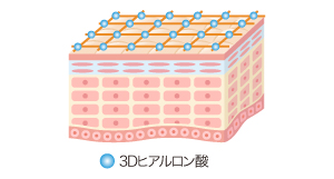 3Dヒアルロン酸